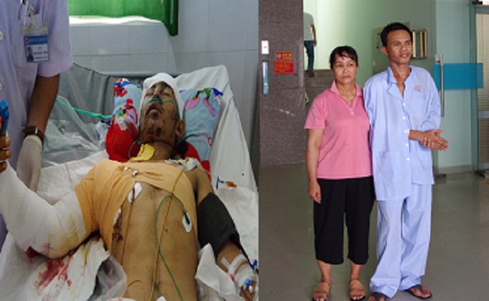 Bệnh viện Quân Y 87: Phẫu thuật thành công cứu sống bệnh nhân bị đa chấn thương nặng