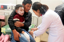 ha tinh no binh gas tai hoi cho tuoi tho 7 hoc sinh tieu hoc bi bong nang