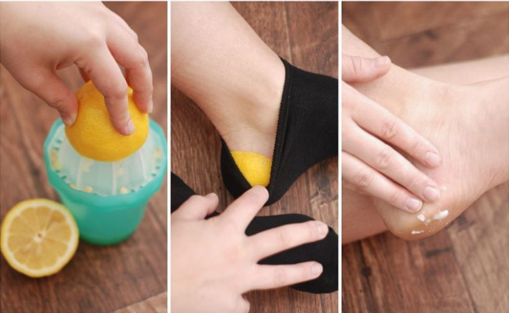 10 c&ocirc;ng thức hữu &iacute;ch gi&uacute;p g&oacute;t ch&acirc;n kh&ocirc;ng c&ograve;n nứt nẻ, kh&ocirc; cứng