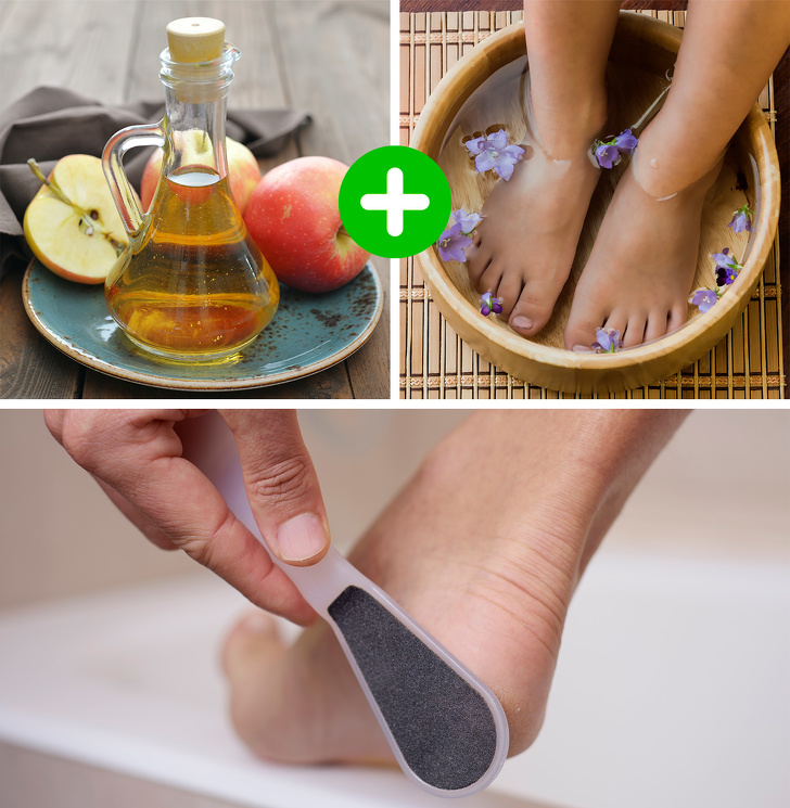 10 c&ocirc;ng thức hữu &iacute;ch gi&uacute;p g&oacute;t ch&acirc;n kh&ocirc;ng c&ograve;n nứt nẻ, kh&ocirc; cứng