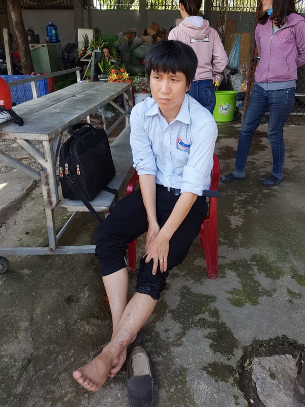 Đồng Nai: Xe khách biển số Khánh Hòa chạy ngược chiều ép lái làm 1 CSGT và 1 người đi đường bị thương