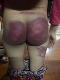 thanh hoa cong an vao cuoc vu be gai 8 tuoi nghi bi bo danh dap