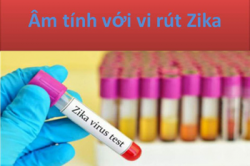 co hon 200 mau benh pham xet nghiem virus zika am tinh