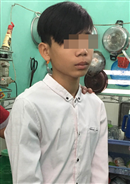 bat giu khan cap nghi pham 15 tuoi dung dao cua co lai xe om cuop tai san