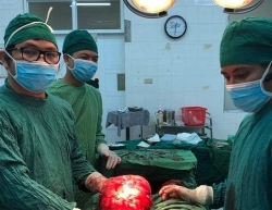 khanh hoa phau thuat thanh cong dua thai nhi ra khoi khoi nhan xo lon