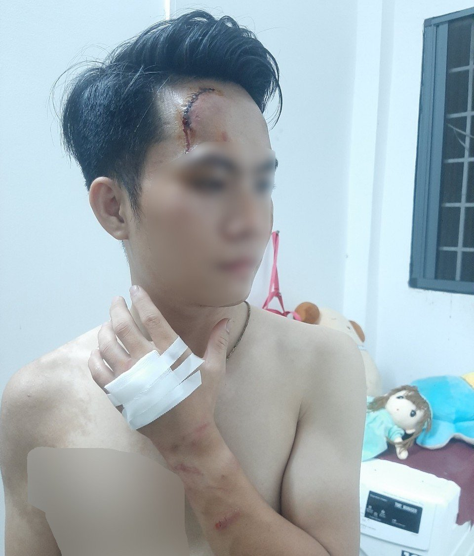 Nghi vấn phóng viên bị hành hung do viết bài phản ánh các cơ sở gây ô nhiễm môi trường