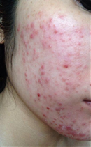 tan pha dung nhan vi my pham gia re