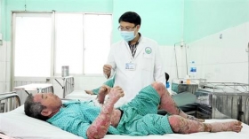 mua thuoc tri vay nen tren mang mot nguoi bi sung vu nut ne