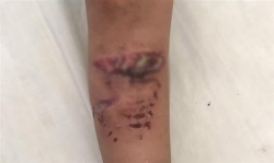 khanh hoa cho pitpull can gay thuong tich cho chau be 28 thang tuoi