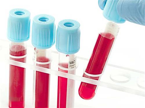 Nghiên cứu biến đổi nồng độ Lactate máu và mối liên quan với tỉ lệ tử vong ở bệnh nhân suy đa tạng
