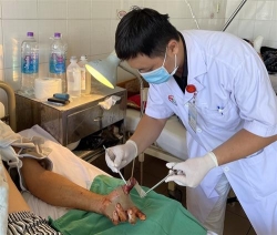 mot benh nhan bi dut lia 3 ngon tay do tai nan lao dong da duoc noi lai thanh cong