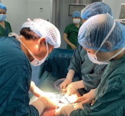 Bệnh viện 22-12 cứu sống bệnh nhân bị xuất huyết nặng do u xơ tử cung