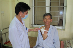thanh cong ky thuat moi dat buong tiem truyen duoi da cho benh nhan ung thu