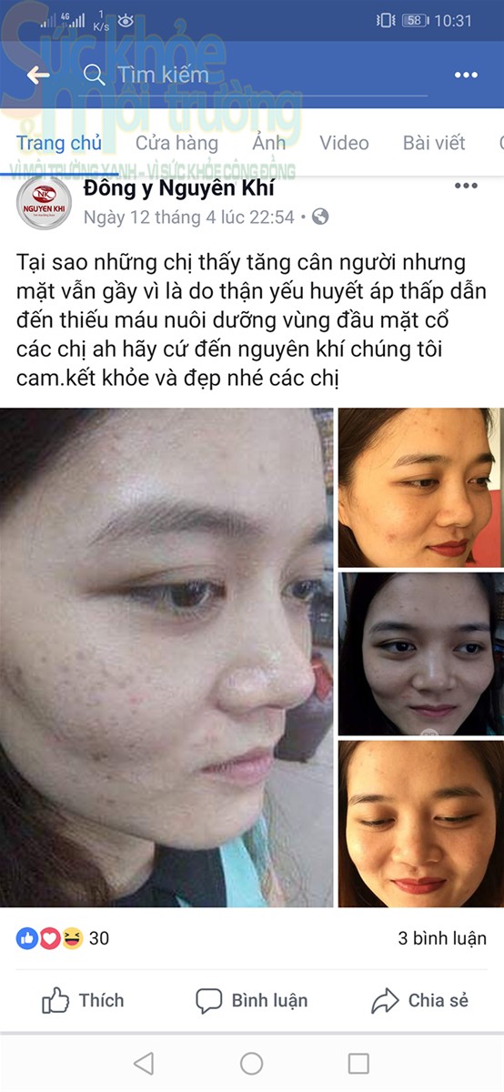 C&ocirc;ng ty Nguy&ecirc;n Kh&iacute; bị tố v&igrave; sử dụng dịch vụ v&agrave; sản phẩm k&eacute;m chất lượng