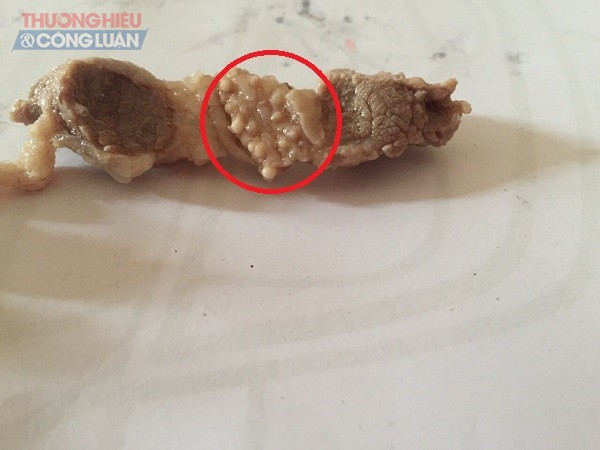 Quốc Oai (Hà Nội): Thịt lợn trong bữa ăn trưa tại Trường Mầm non Bách Anh nghi bị nhiễm sán gạo khiến dư luận xôn xao?