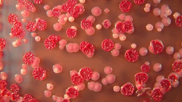 Bệnh Whitmore l&agrave; g&igrave;, dấu hiệu nhận biết ra sao?