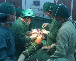 khanh hoa phau thuat roi loan phat trien sun tang truong dau duoi xuong dui 2 ben cho benh nhi