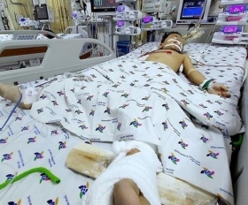 treo qua may giat ra ngoai ban cong choi be 5 tuoi roi tu tang 12 xuong dat