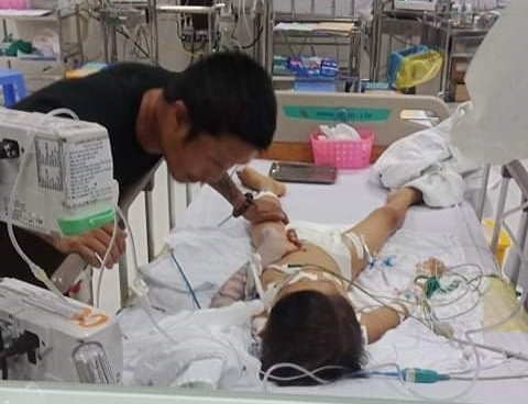 Bé 7 tuổi ngưng tim, hôn mê sau ca mổ lấy đinh nẹp ở tay