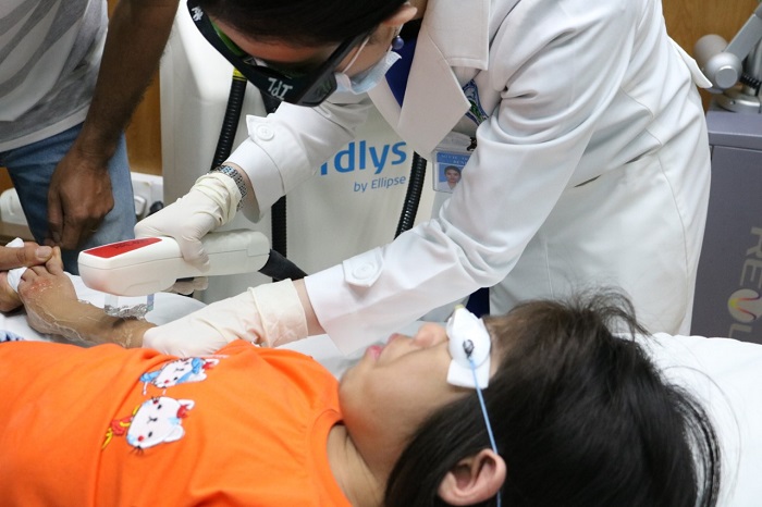 Bé gái 6 tuổi mắc bệnh di truyền hiến gặp, mọc lông rậm toàn thân