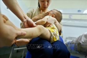 cac co so y te san sang tiep nhan va dieu tri benh tay chan mieng