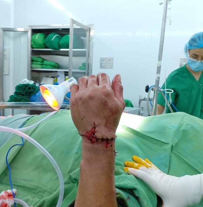 Bệnh viện Đa khoa tỉnh Khánh Hòa: Phẫu thuật thành công nối 2 ca đứt lìa chi thể