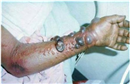 ebola co lay qua duong tinh duc