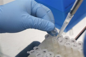 vaccine phong ngua virus zika cho tin hieu kha quan