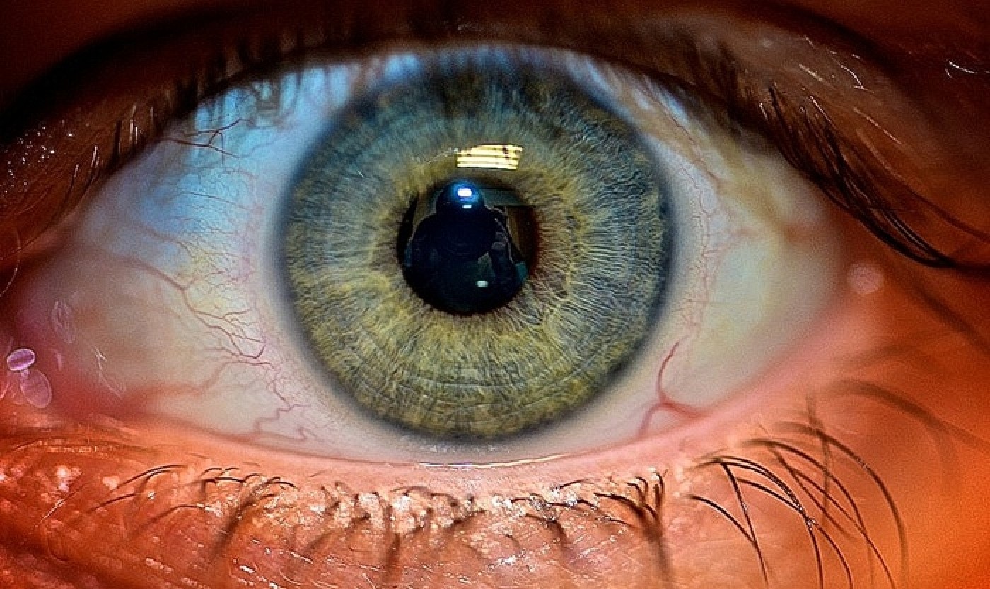 Retinal - thủ phạm gây bệnh thoái hóa thị lực (DMLA)