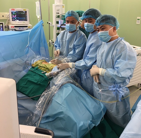 Phương pháp mới điều trị hiệu quả sỏi thận