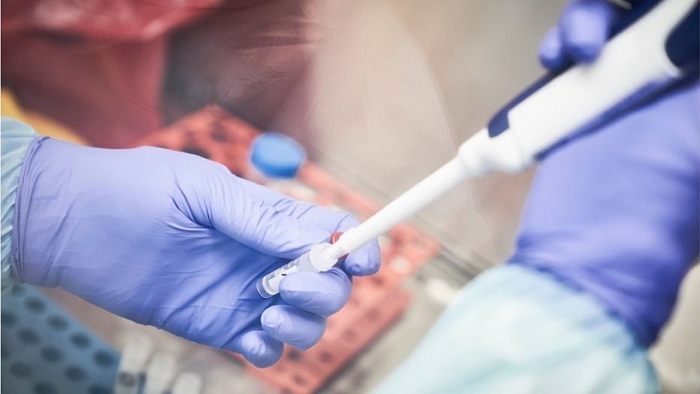 Chưa có Vaccine phòng Covid-19, nhưng các nước đã làm loạn thị trường