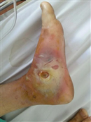 hoai tu chan vi chua meo vet phong po xe