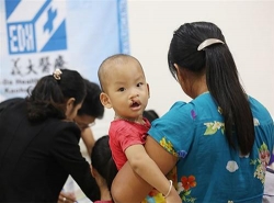 hon 100 tre khuyet tat duoc phau thuat nu cuoi mien phi o vinh