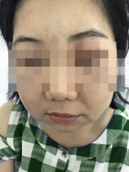 su dung te bao goc lam dep can trong dung de tien mat tat mang