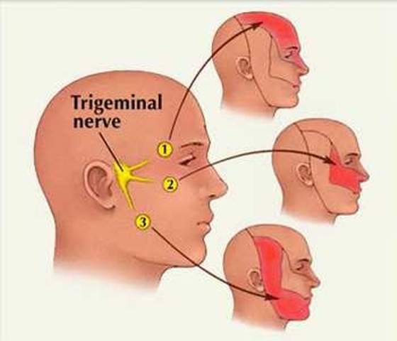 Hướng điều trị mới cho bệnh nhân đau dây thần kinh 