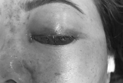 tiem filler mu mat khach chu spa bi phat 120 trieu