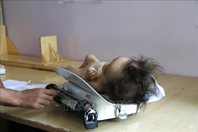 UNICEF: Tình trạng suy dinh dưỡng ở trẻ em tại nhiều nước trên thế giới ngày càng tồi tệ