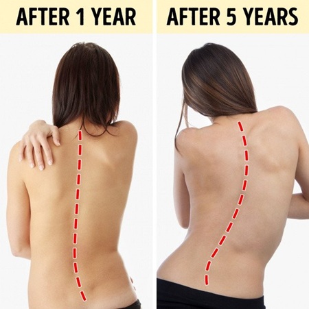 Sự nguy hiểm của lối sống &iacute;t vận động