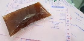 tphcm phat hon 93 trieu dong 1 phong chan tri y hoc co truyen