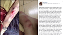 co gai bi tan cong trong dem thua nhan bia chuyen