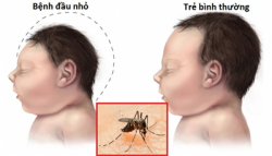 tphcm phat hien them 22 truong hop nhiem virus zika