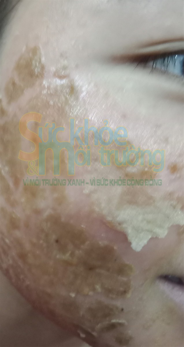 C&ocirc;ng ty TNHH Mỹ Duy&ecirc;n Beauty: 'Thổi phồng' h&agrave;ng loạt mỹ phẩm như thuốc chữa bệnh, 'bẫy' người ti&ecirc;u d&ugrave;ng