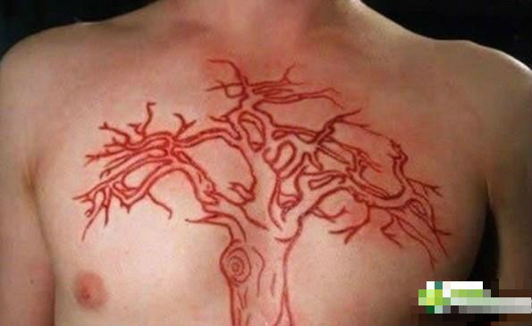 C&amp;ograve;n kinh khủng hơn mốt đeo khuy&amp;ecirc;n, nong lỗ tai...kh&amp;ocirc;ng &amp;iacute;t d&amp;acirc;n chơi đ&amp;atilde; lao đầu v&amp;agrave;o th&amp;uacute; chơi lột da - một biến tướng r&amp;ugrave;ng rợn của mốt xăm m&amp;igrave;nh.