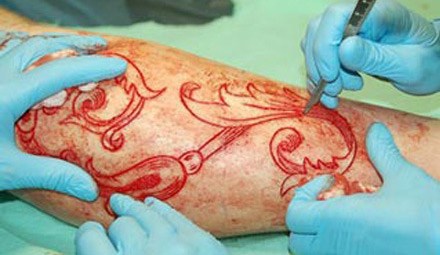C&amp;ograve;n kinh khủng hơn mốt đeo khuy&amp;ecirc;n, nong lỗ tai...kh&amp;ocirc;ng &amp;iacute;t d&amp;acirc;n chơi đ&amp;atilde; lao đầu v&amp;agrave;o th&amp;uacute; chơi lột da - một biến tướng r&amp;ugrave;ng rợn của mốt xăm m&amp;igrave;nh.