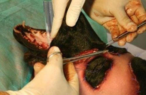 Sốc: Ch&amp;agrave;ng trai phẫu thuật để th&amp;agrave;nh ch&amp;oacute; - 6