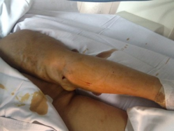 tien giang canh tay bien dang vi bi manh dan gam hon 40 nam