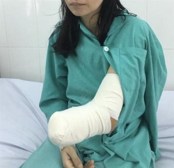 nhieu benh nhan phai cat cut chi do tai nan lao dong