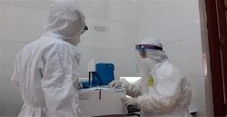 dinh nghia lai cac truong hop mac covid 19 trong tinh hinh moi